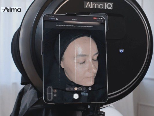 A face being scanned inside the Alma IQ analyzer